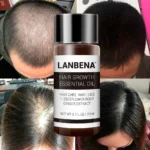 روغن تقویت و رشد مو لانبنا مناسب ضد ریزش مو و ضخیم کننده تارهای مو کد 0380